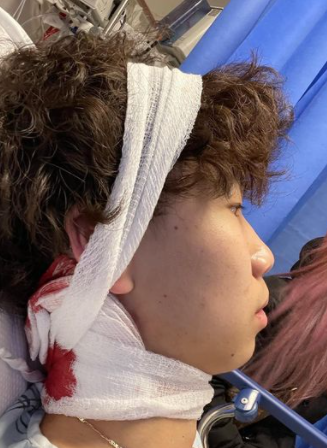 327px x 448px - Young Asian influencer slashed in head on Bowery - The Village Sun